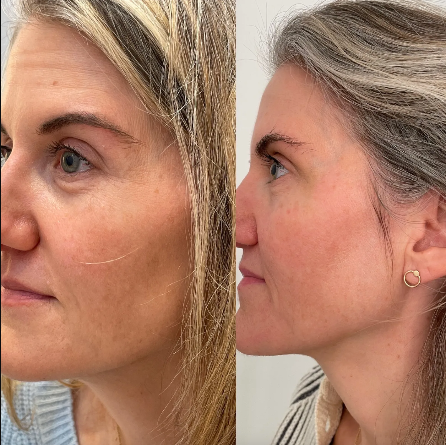 Nest & Co ~ Even Tone Collagen Mask